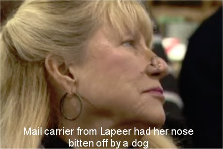 Michigan mail carrier attacked by dog speaks out